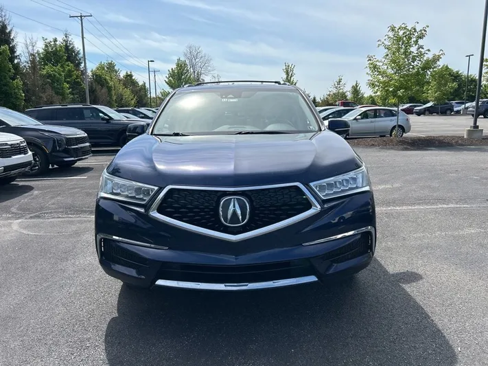 2017 Acura MDX - view 2